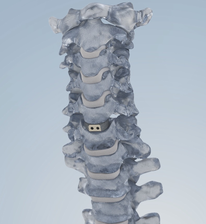 Spine